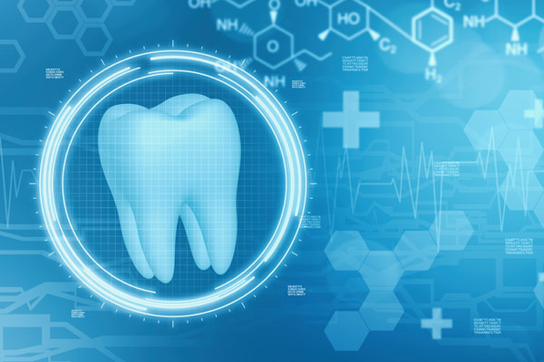 3D rendering of mouth with multiple dental implants