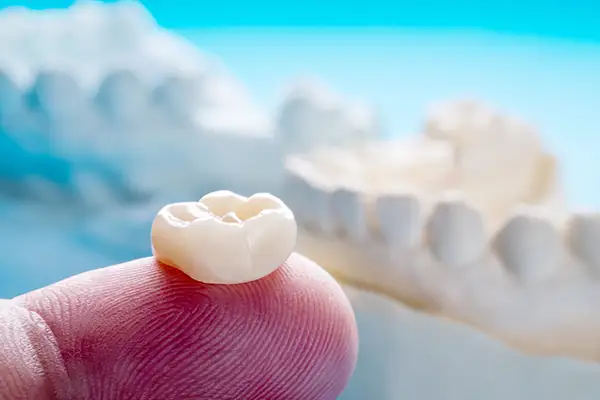 Close-up of a single ceramic dental crown resting on a fingertip, with a dental model blurred in the background.