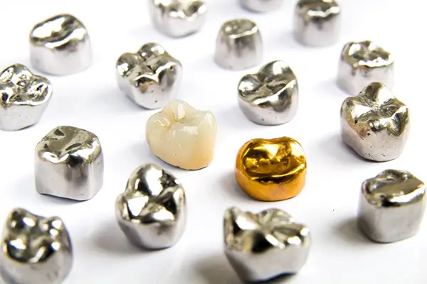 dental crown materials 4