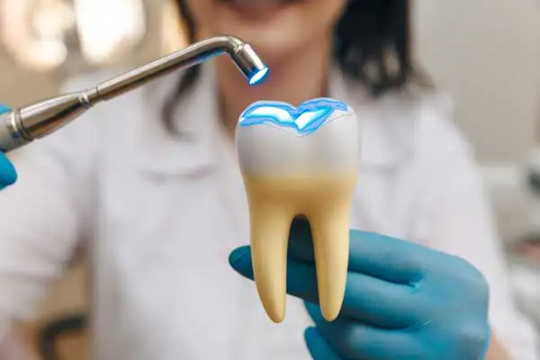 dental filling 2