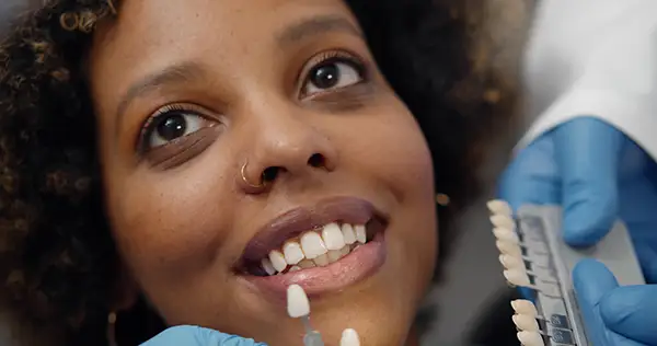 Dental veneers and a lady holding them